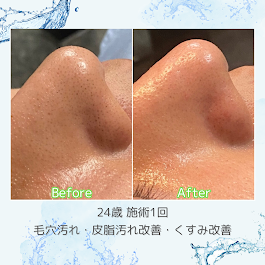 Images Blue beedro -メンズ美肌科学研究所-