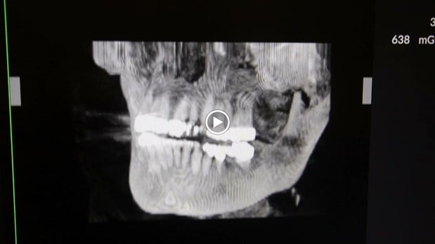 Images Broadview Dental Care | Glendale, CA