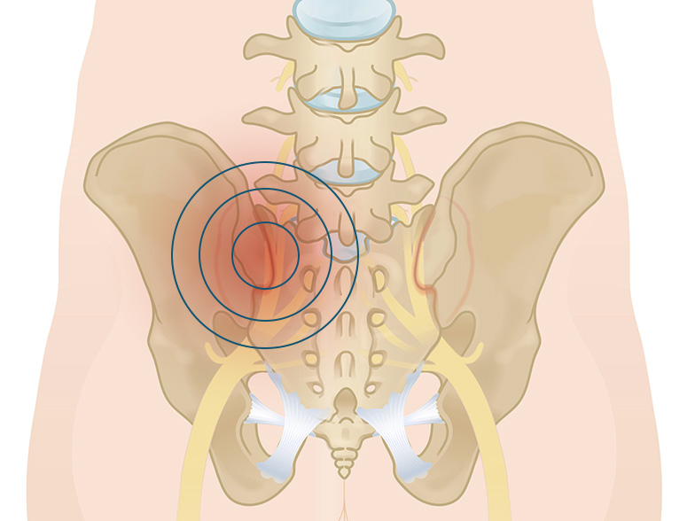 Cncrns_Cndtns-hippain-back-392x294@2x.jpg