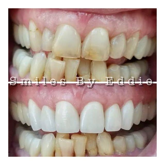 Images Smiles By Eddie: Dr. Edmond Ahdoot DDS
