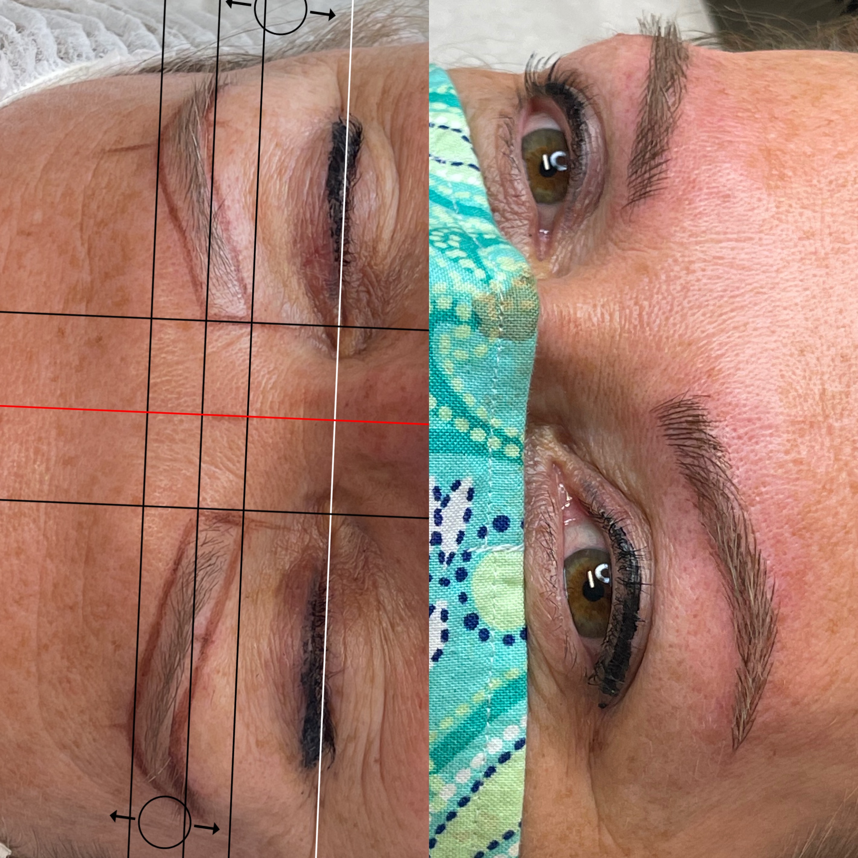Images Clinique d'Esthétique Leila - Hydrafacial, Microblading, Épilation Laser Sainte-Foy