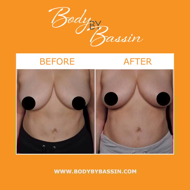 Images Body By Bassin Melbourne