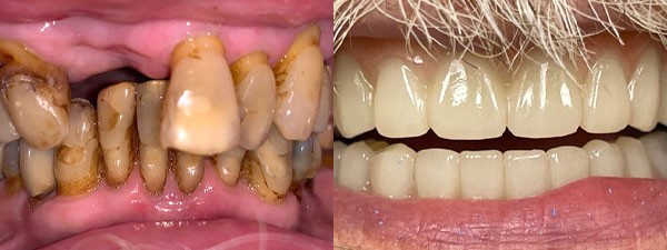 Images Riverside Family Dental
