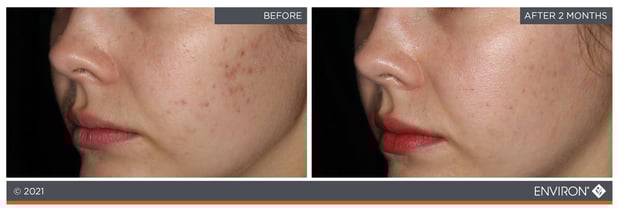 Images Celtic Spa & Laser Services