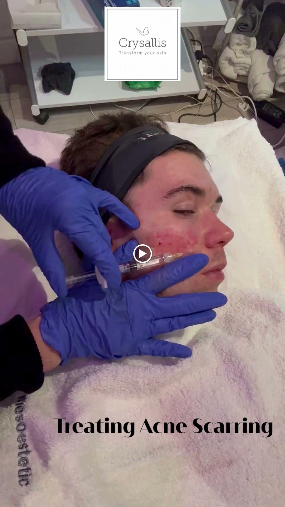 Images Crysallis Skin Clinic