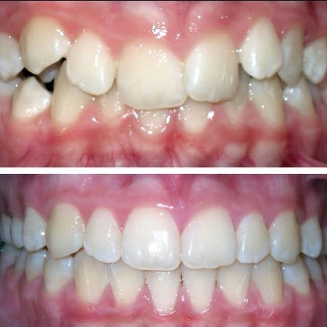 Images Smiles By Eddie: Dr. Edmond Ahdoot DDS
