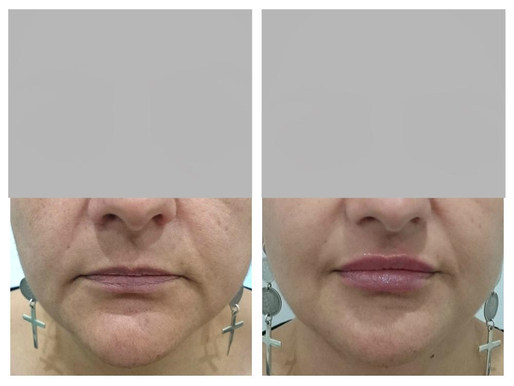 Images About Face Medical Aesthetics - Richmond