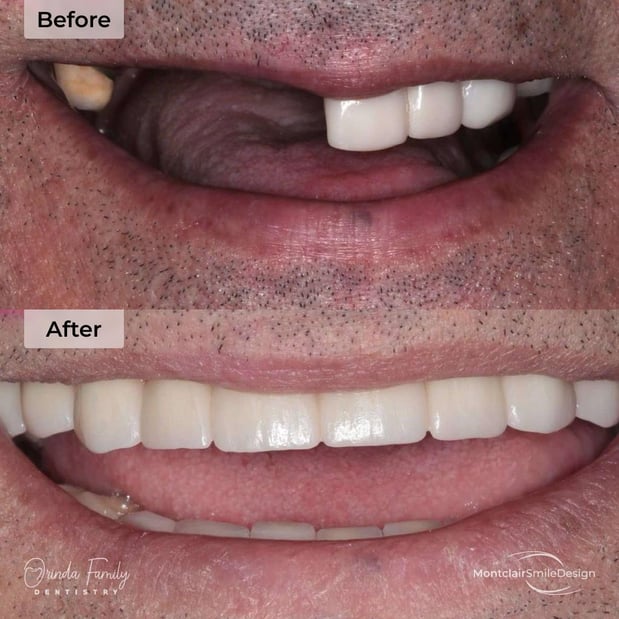 Images Orinda Family Dentistry