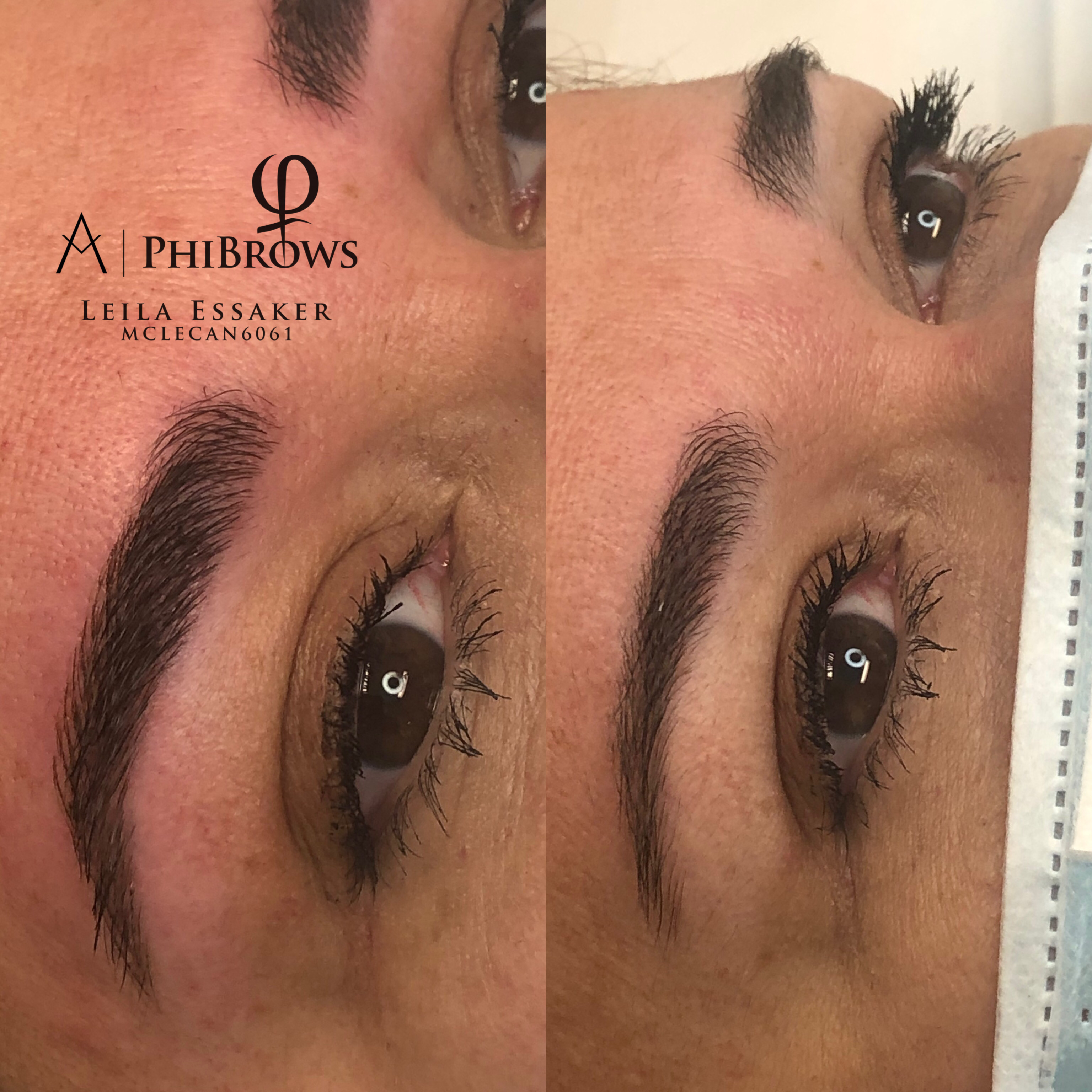 Images Clinique d'Esthétique Leila - Hydrafacial, Microblading, Épilation Laser Sainte-Foy