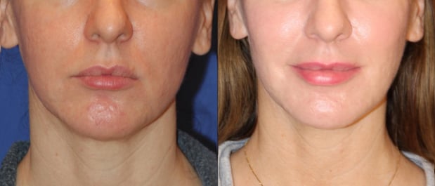 Images Troell Cosmetic Surgery & Facial Plastic Clinic