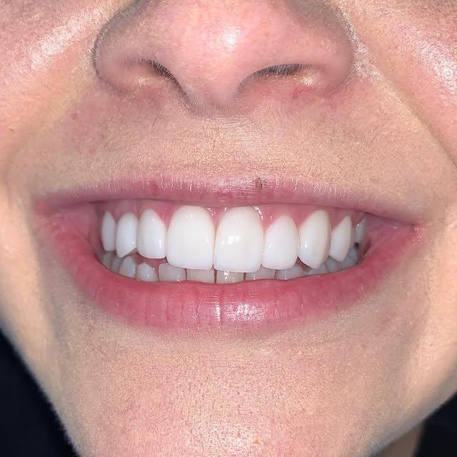 Images Smiles By Eddie: Dr. Edmond Ahdoot DDS