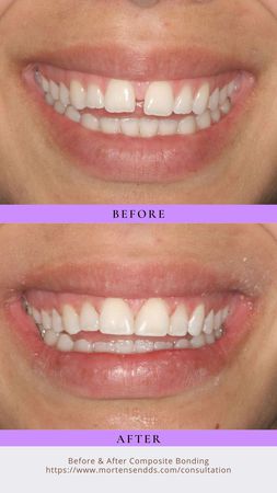 Images Andrew G. Mortensen, DDS
