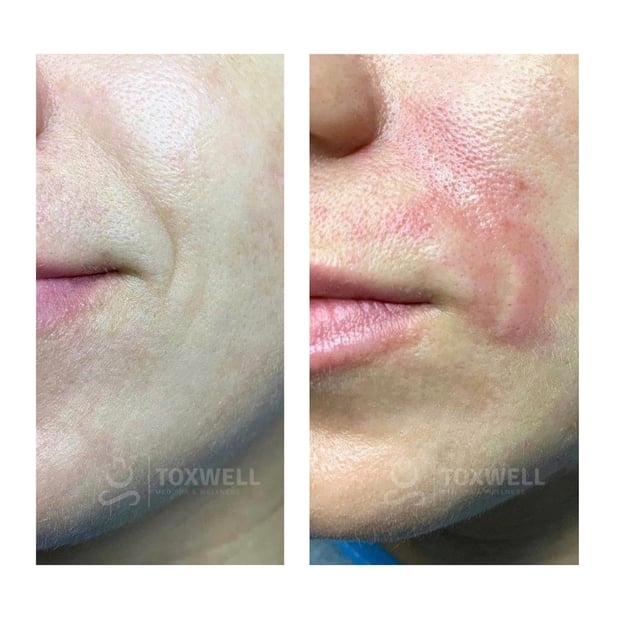 Images Toxwell Med Spa and Wellness