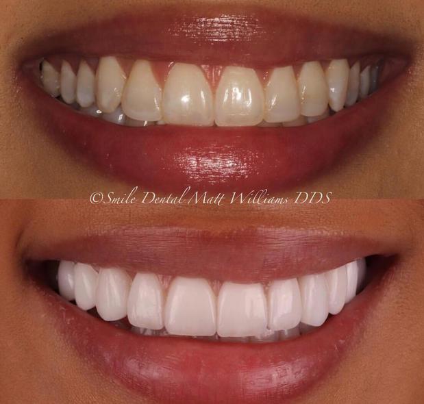 Images Smile Dental