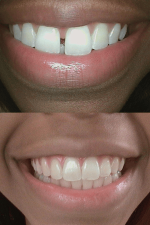Images SoftTouch Dentistry of Newton