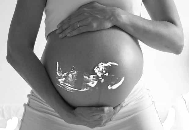 Images Heavenly 3D 4D Ultrasounds