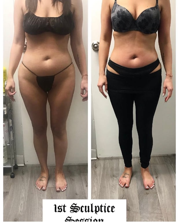 Images Queen Divas Body Sculpting