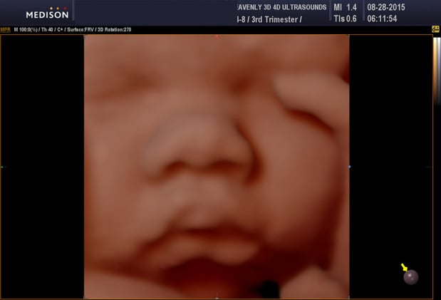 Images Heavenly 3D 4D Ultrasounds