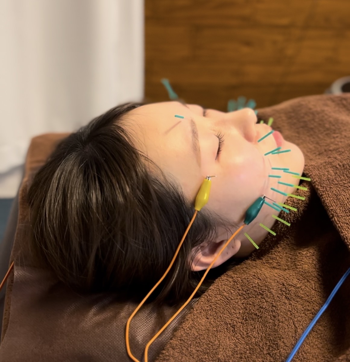 Images 鍼処MINAOSHI