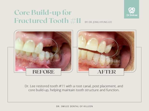 Images Dr Smilee Dental of Killeen, Family, Cosmetic, Implant, Medspa