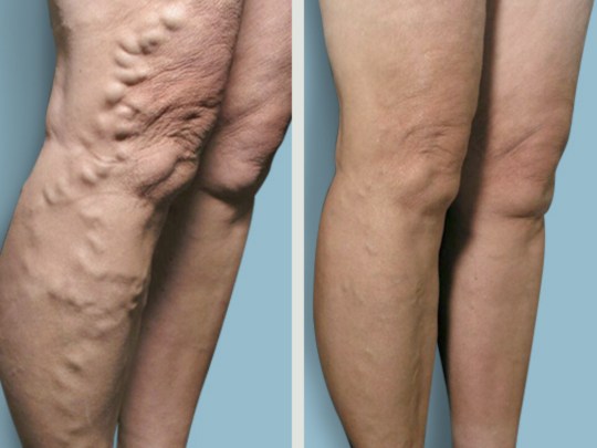 Images Metro Vein Centers | Clear Lake