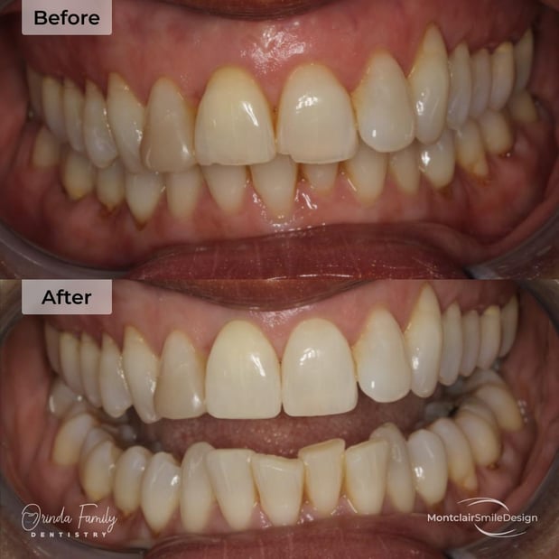 Images Orinda Family Dentistry