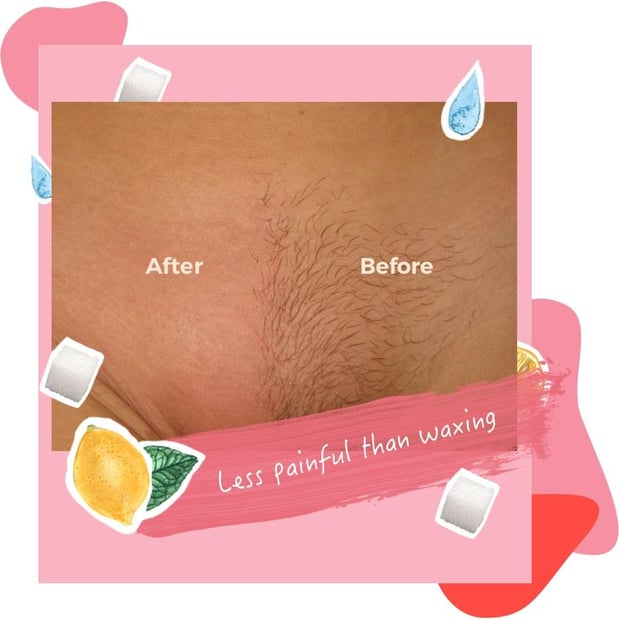 Images Sugaring NYC - West Palm Beach Wellington