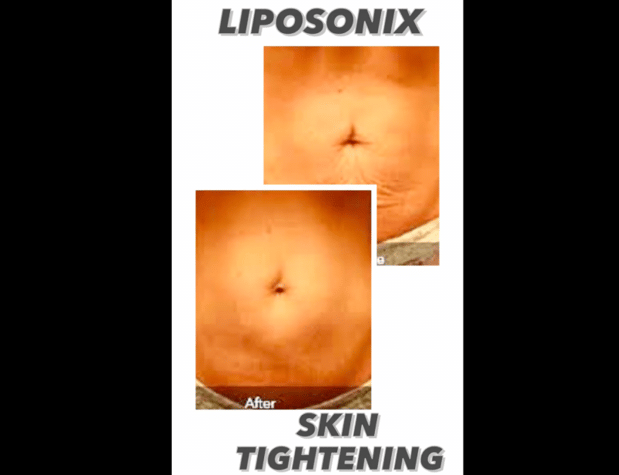 Images Renew Body Contouring & MedSpa