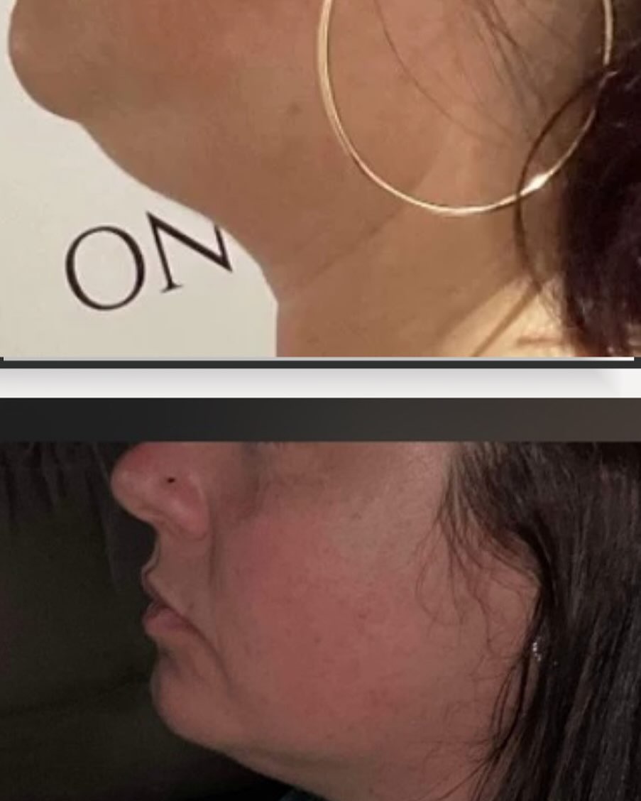 Images Onyx Esthétique - Soins esthétiques, Soins de la peau, Laser Cynosure Gatineau