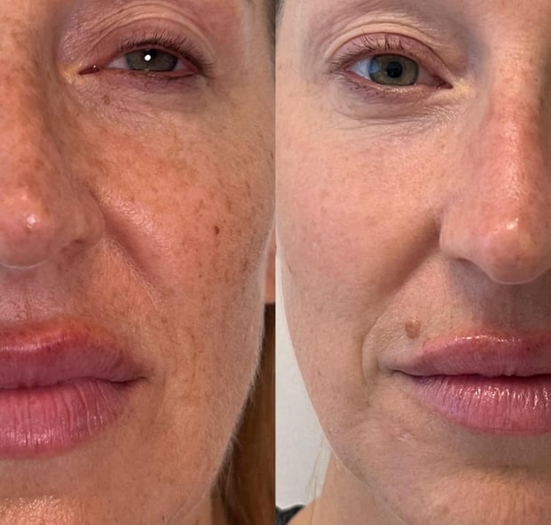 Images Infinity Beauty Lab Med Spa