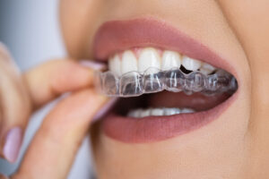 Images Studio Dentistico Zaccarelli