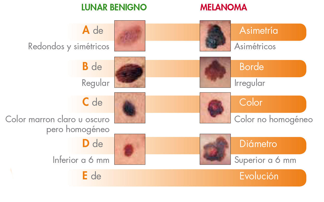 Images Diagnosis Dermatológica