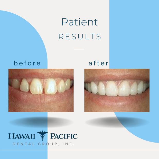 Images Hawaii Pacific Dental Group, Inc.