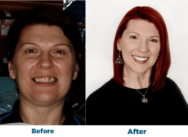 Images Smiles for Life Dental Care - Bridgewater