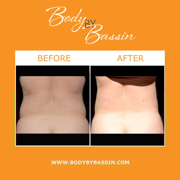 Images Body By Bassin Melbourne