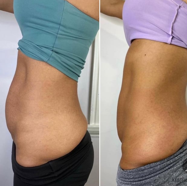 Images RAVE Spa & Clinic