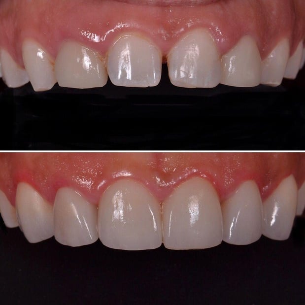 Images Carson Dental & Cosmetic Centre