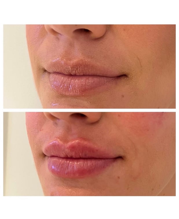 Images Body Lounge Park Cities - Whole Body Wellness & Medical Aesthetics, Dallas, TX