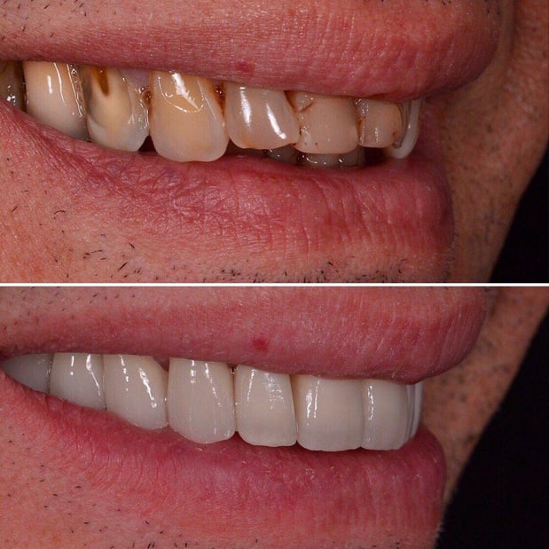Images Carson Dental & Cosmetic Centre