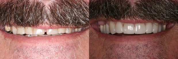 Images Campbell Dental Arts