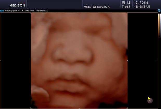 Images Heavenly 3D 4D Ultrasounds