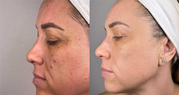 Images Face of Jules