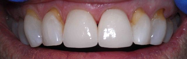 Images Dr. Pavlakos General & Cosmetic Dentistry
