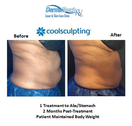 Images DermaTouch RN