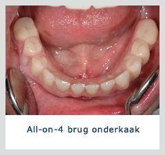 Foto's Kliniek voor Cosmetische Tandheelkunde Amsterdam Zuid