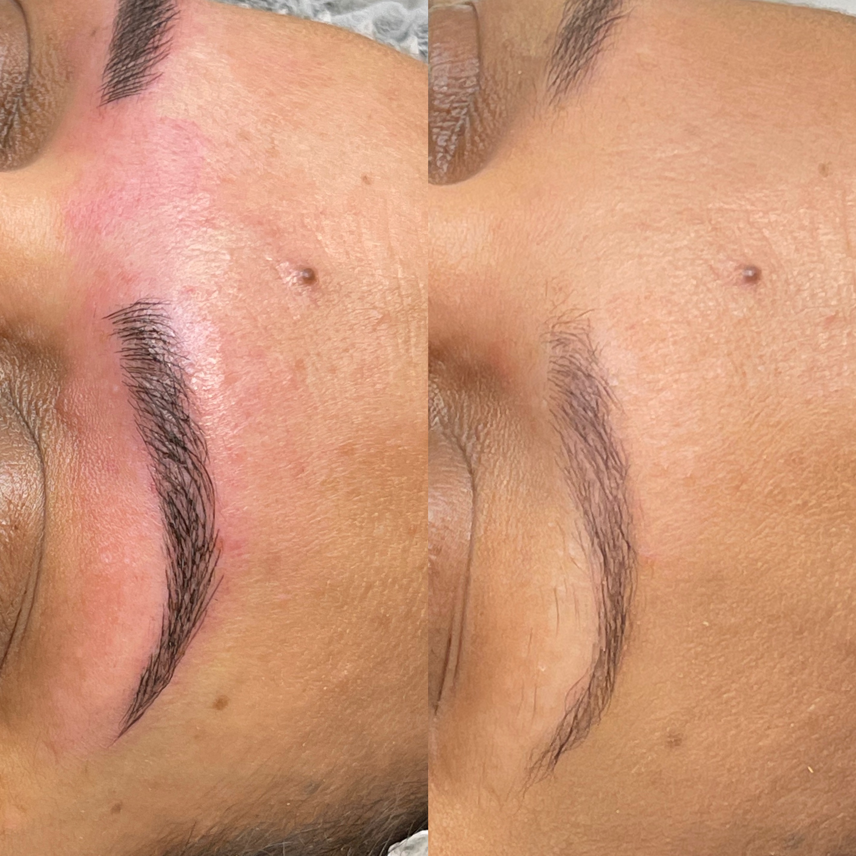 Images Clinique d'Esthétique Leila - Hydrafacial, Microblading, Épilation Laser Sainte-Foy