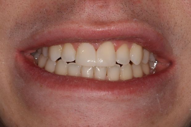 Images Aaron A. Leishman DMD, PA