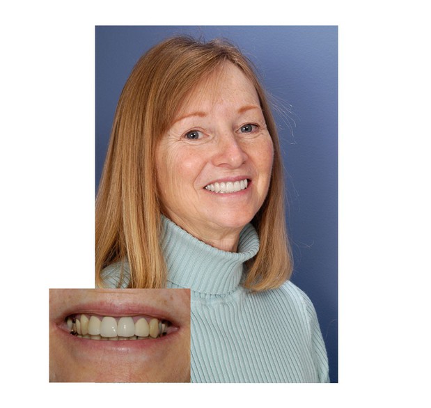 Images San Diego Smiles