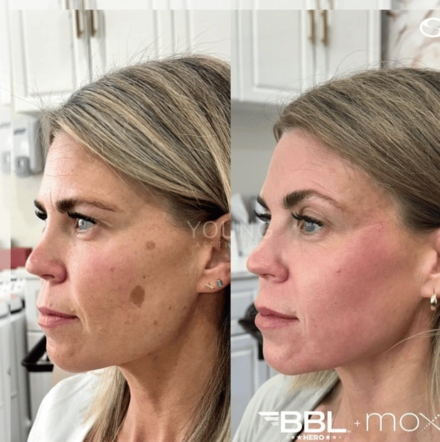 Images Serenity Aesthetics & Wellness