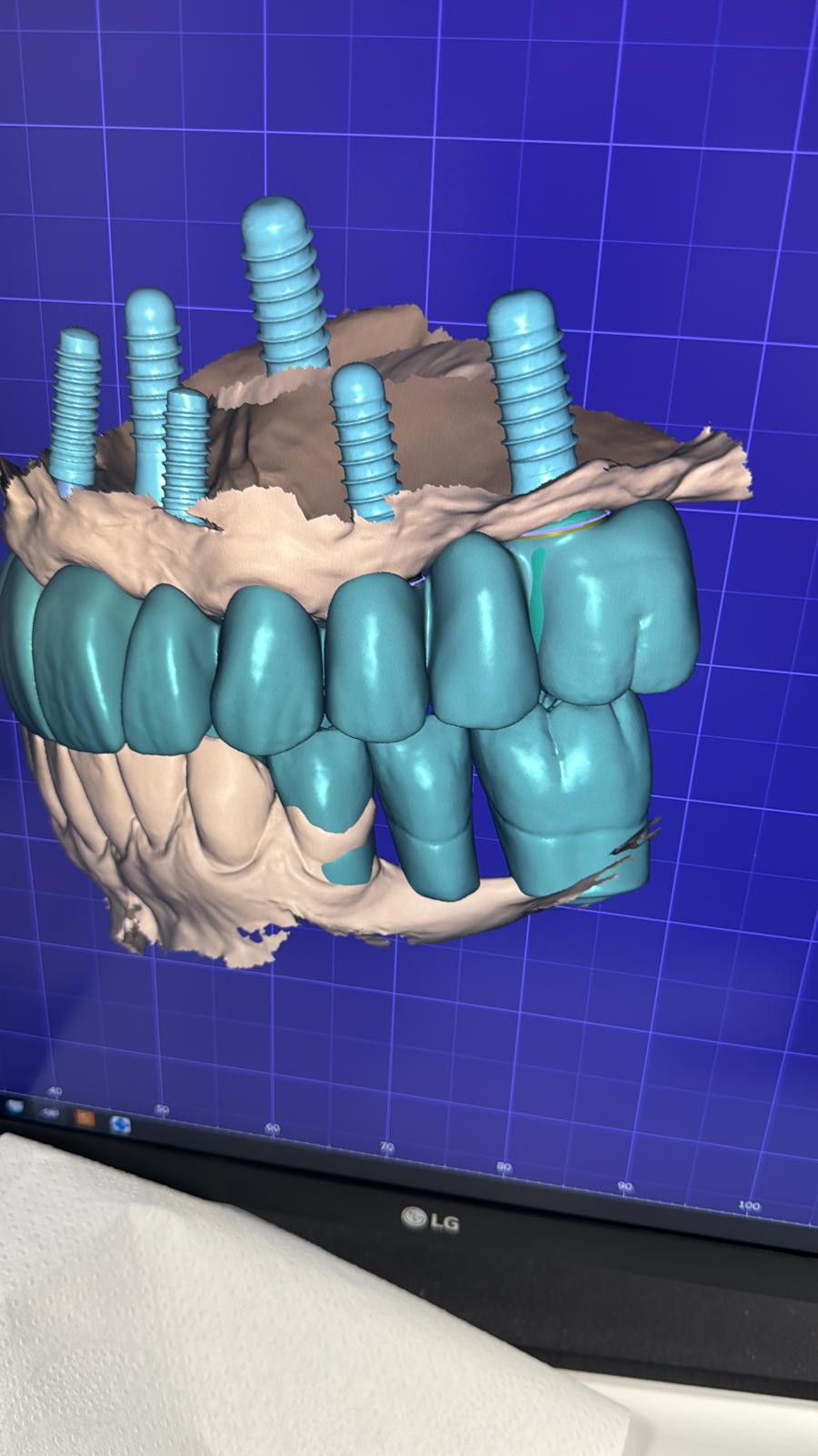 Bilder DentalLook Sagl